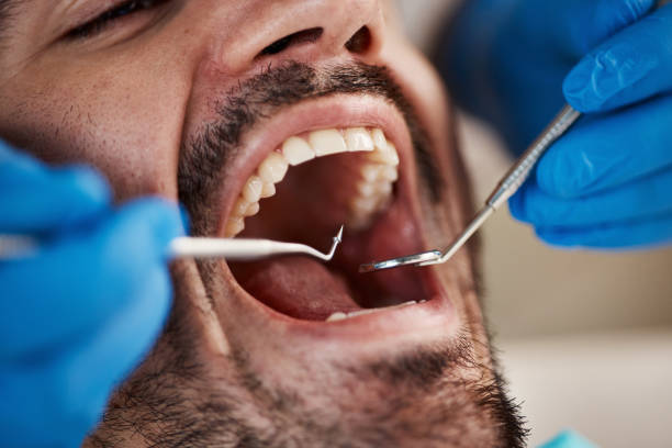 Best Emergency Dental Care for Broken or Chipped Teeth in South Amboy, NJ